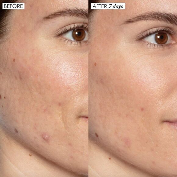 NIB Good Genes All-In-One Lactic Acid Treatment - Sunday Riley - Picture 4 of 8